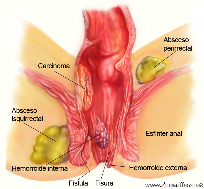 Penetracion Anal Hombre 63